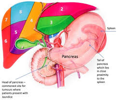 Pancreatic tumours